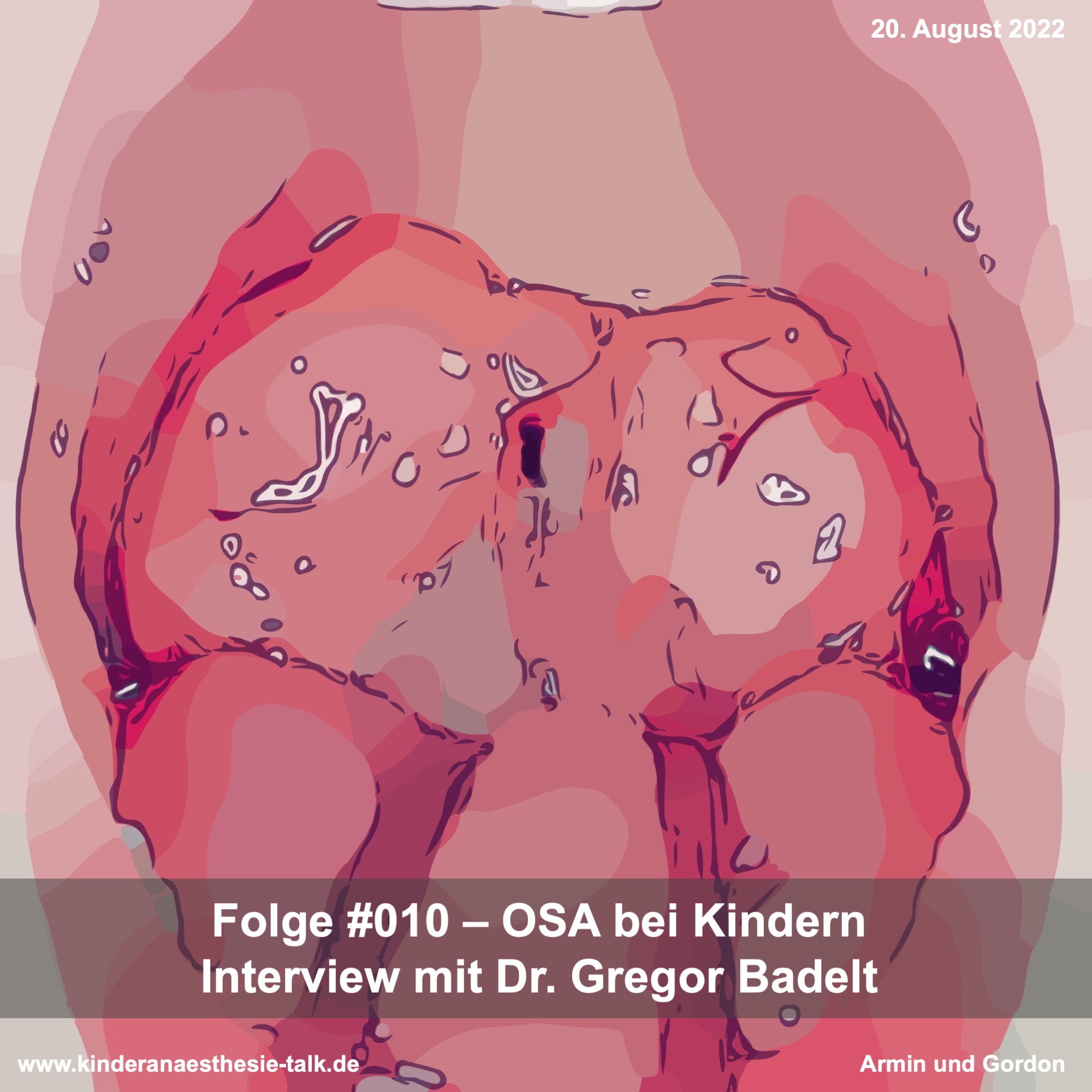 Kinderanästhesie-Talk