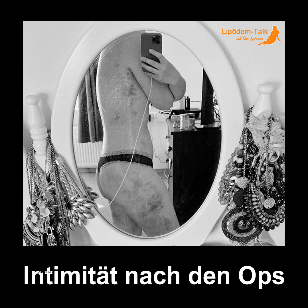 Lipödem & Liposuktion: Intimität und Beziehung nach der Operation episode artwork