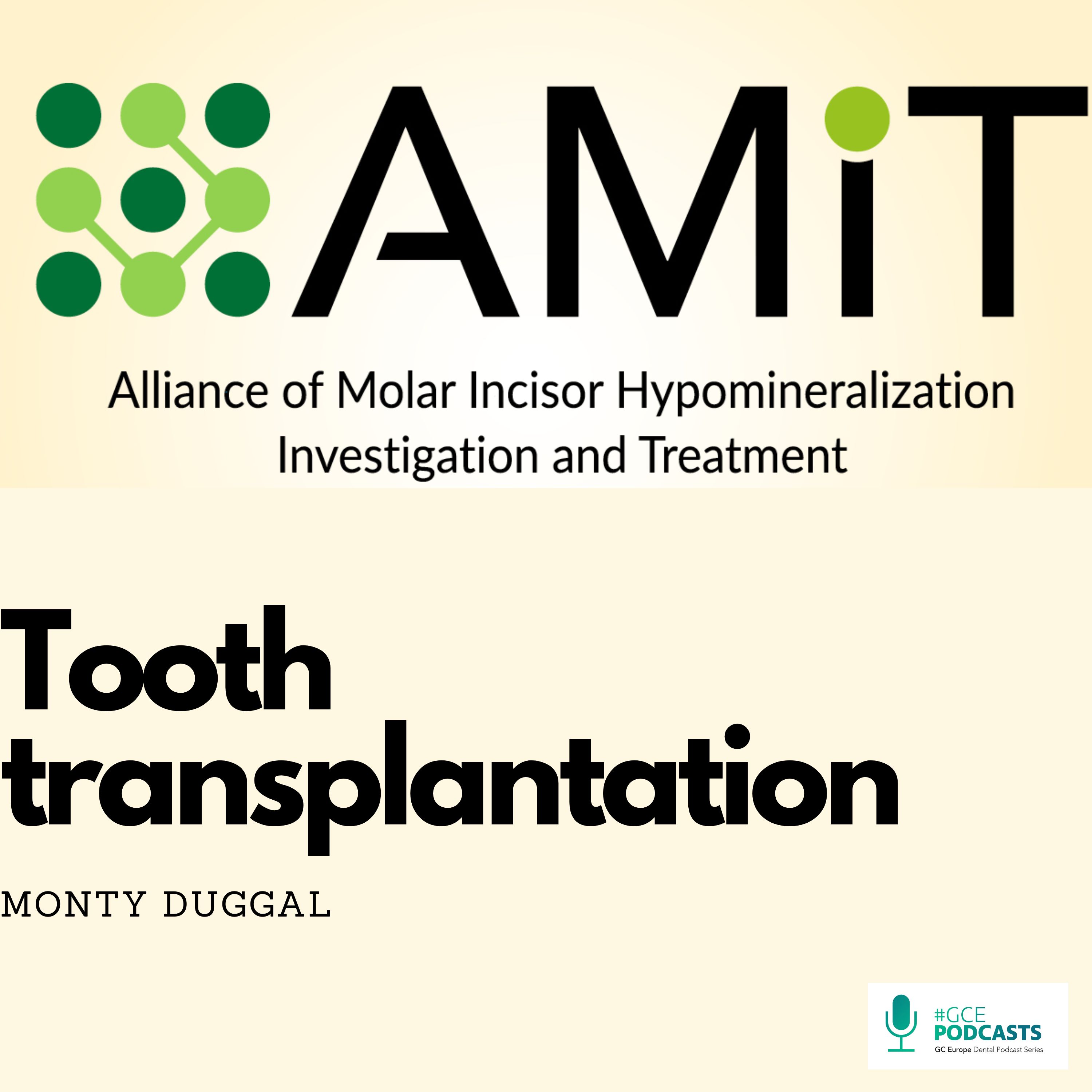 Tooth transplantation - AMIT Podcast episode artwork
