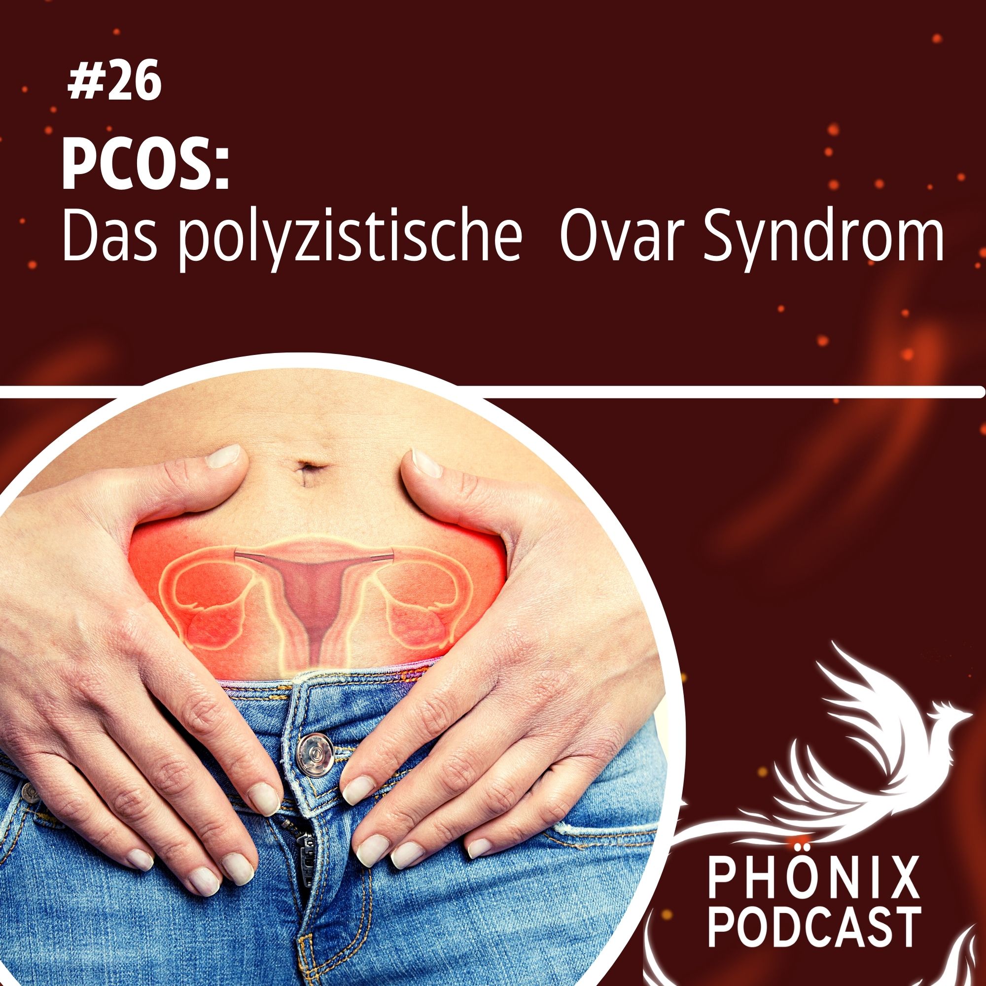 PCOS: Das polyzystische Ovar Syndrom #26 - podcast episode cover