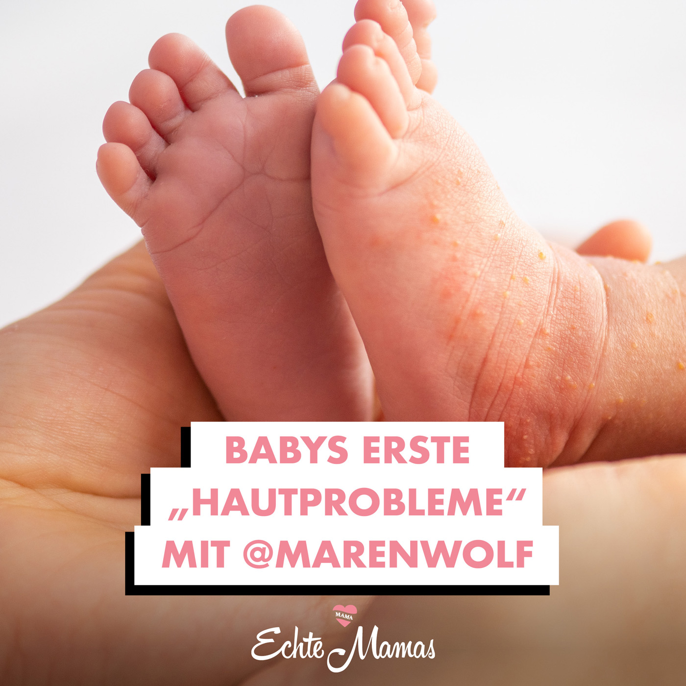 Babys erste Hautprobleme - mit @marenwolf