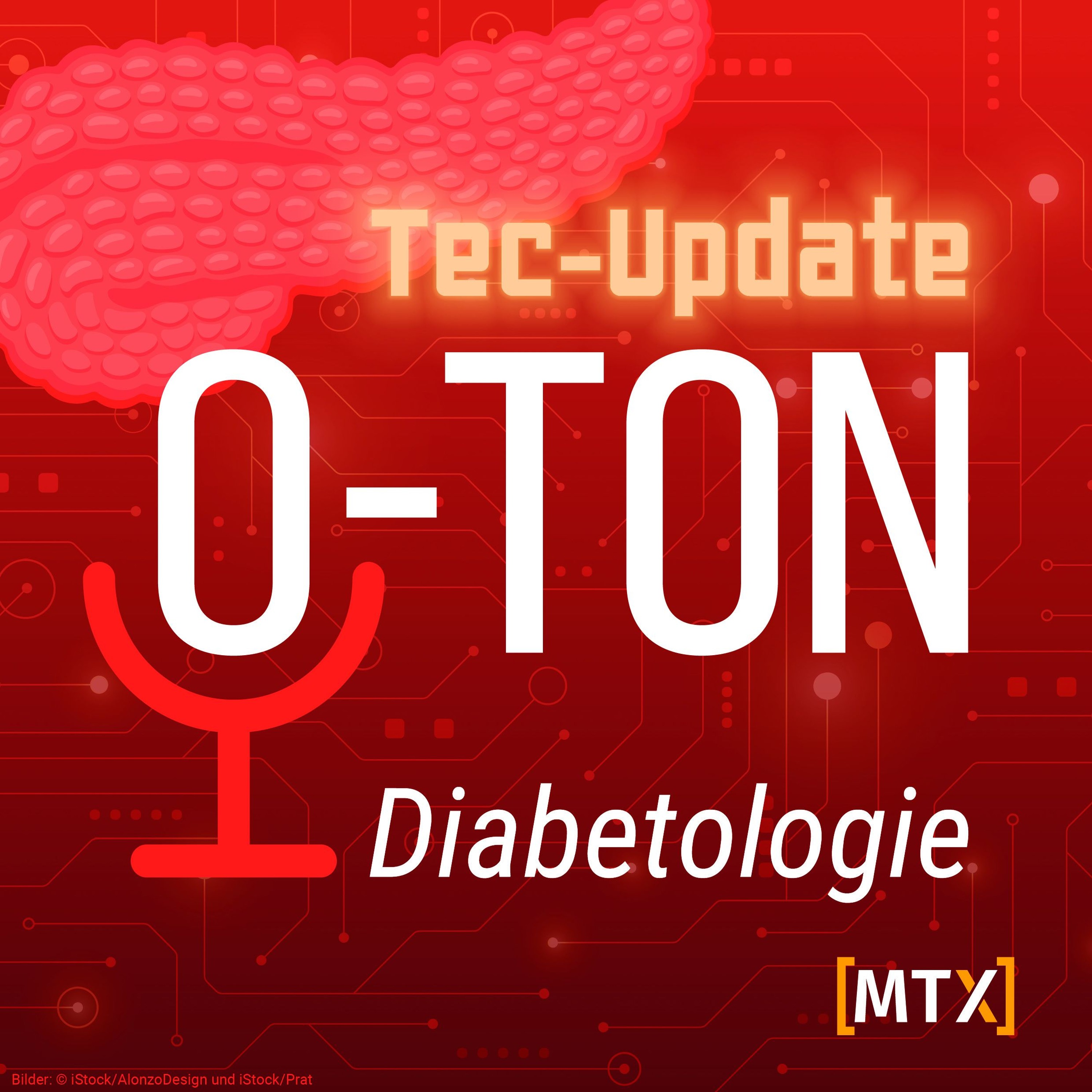 Tec-Update: Trends in der Diabetes-Technologie 2025 und dt-Report-Umfrage episode artwork