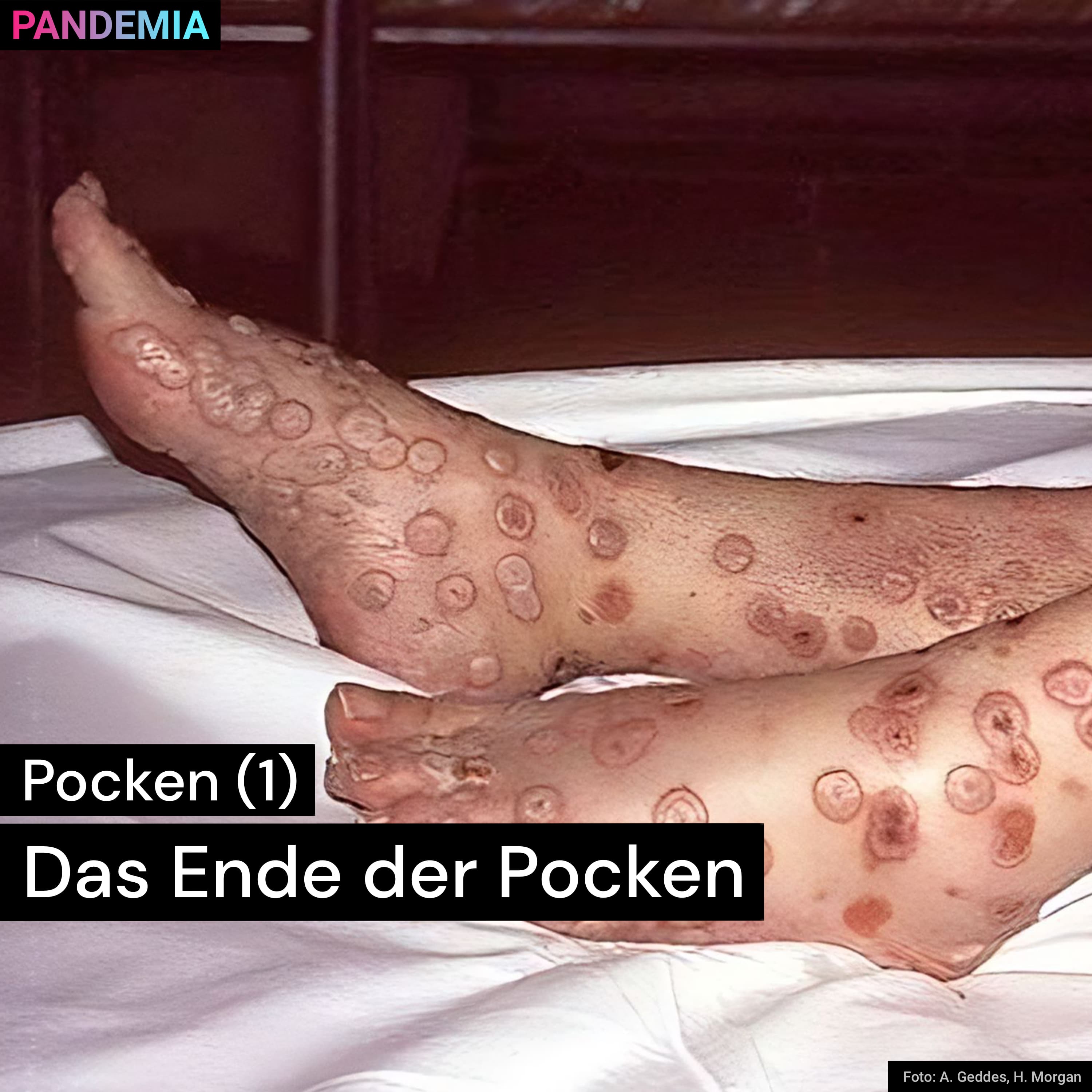 Pandemia