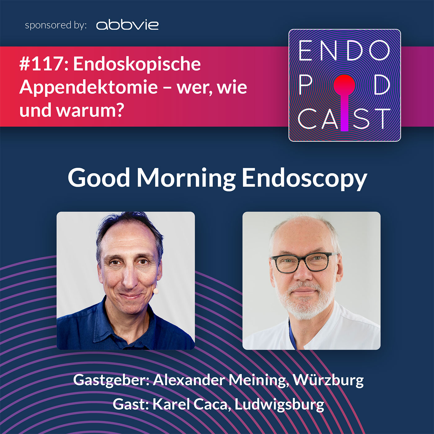 Endoskopische Appendektomie – wer, wie und warum? - mit Karel Caca episode artwork