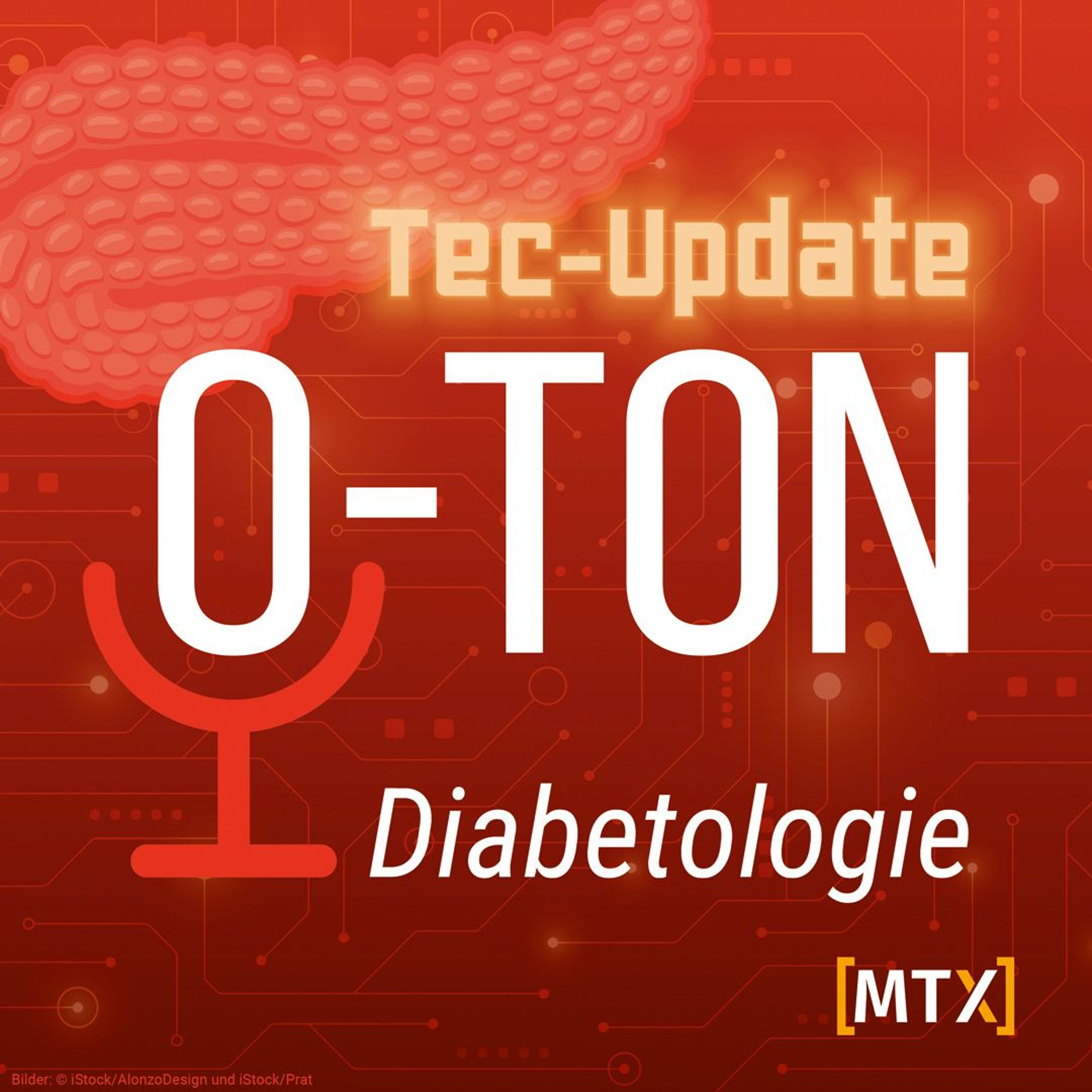 Diabetes-Technologie: Die Ergebnisse des dt-reports 2025 –Teil 1: die Sicht der Behandelnden