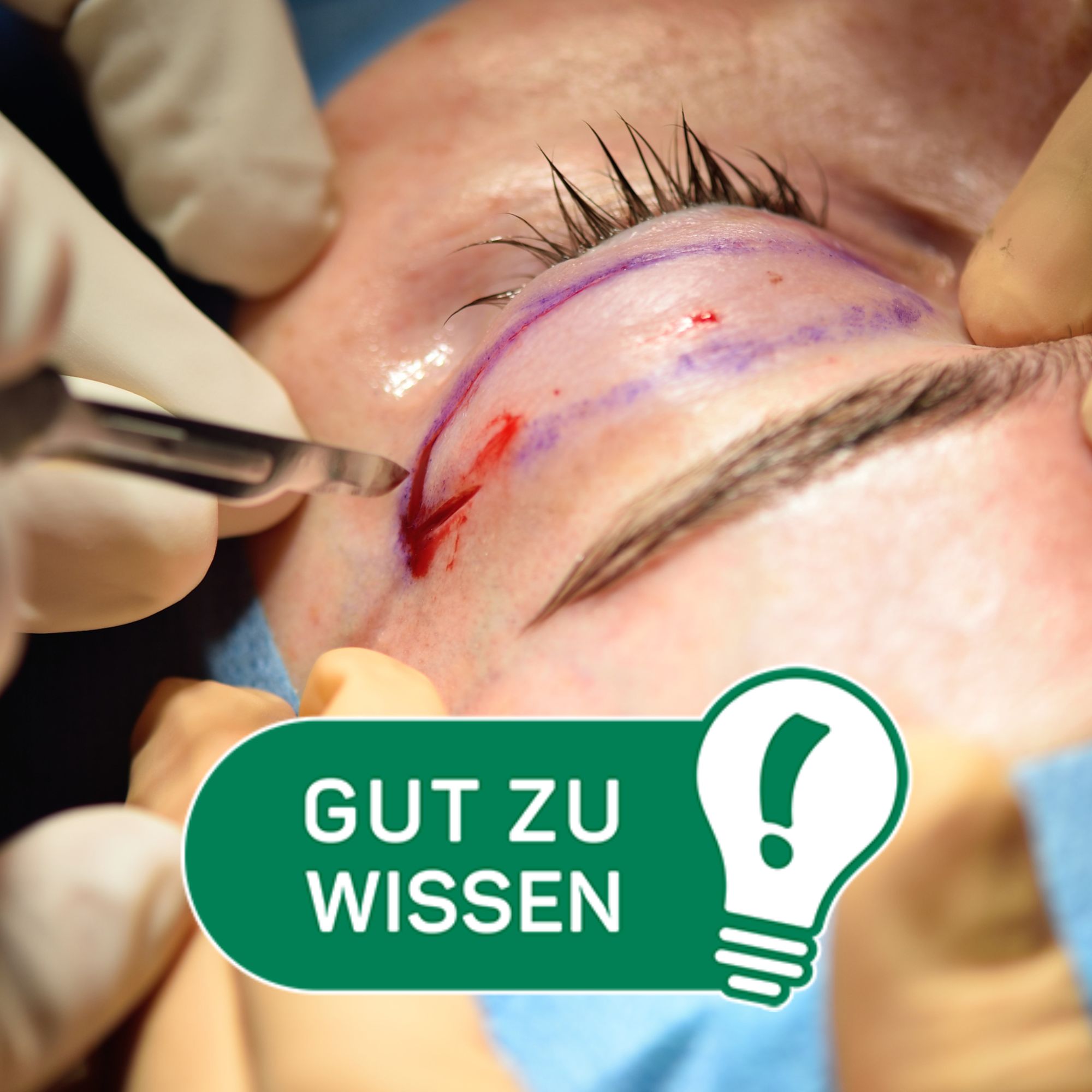 Gut zu wissen: Worauf man bei Schönheitseingriffen achten sollte