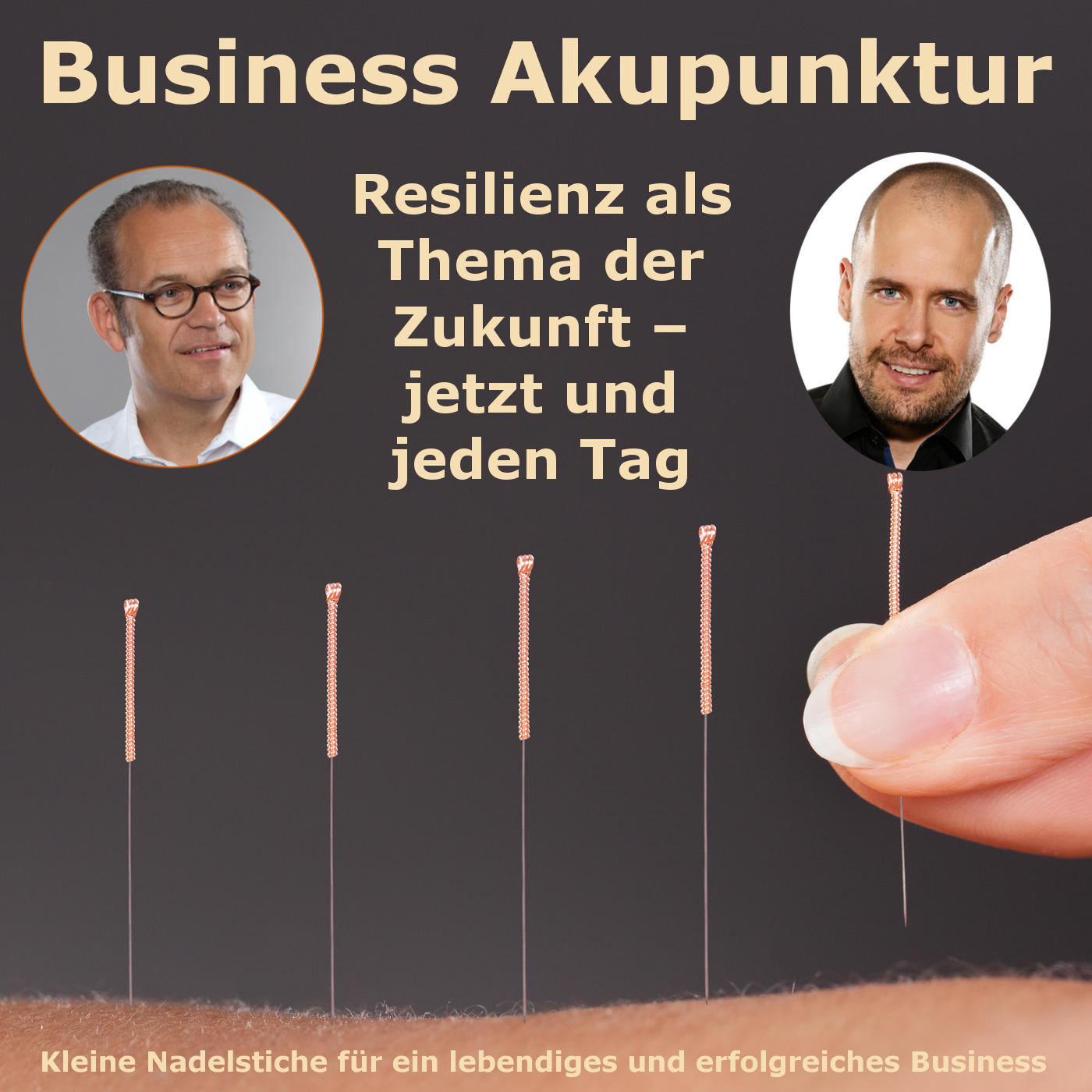 Business Akupunktur
