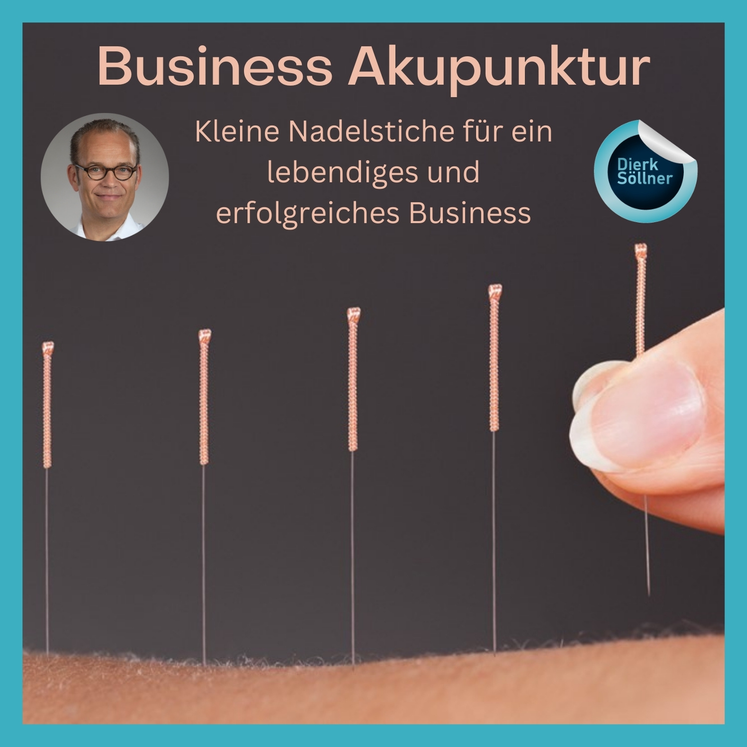 Business Akupunktur