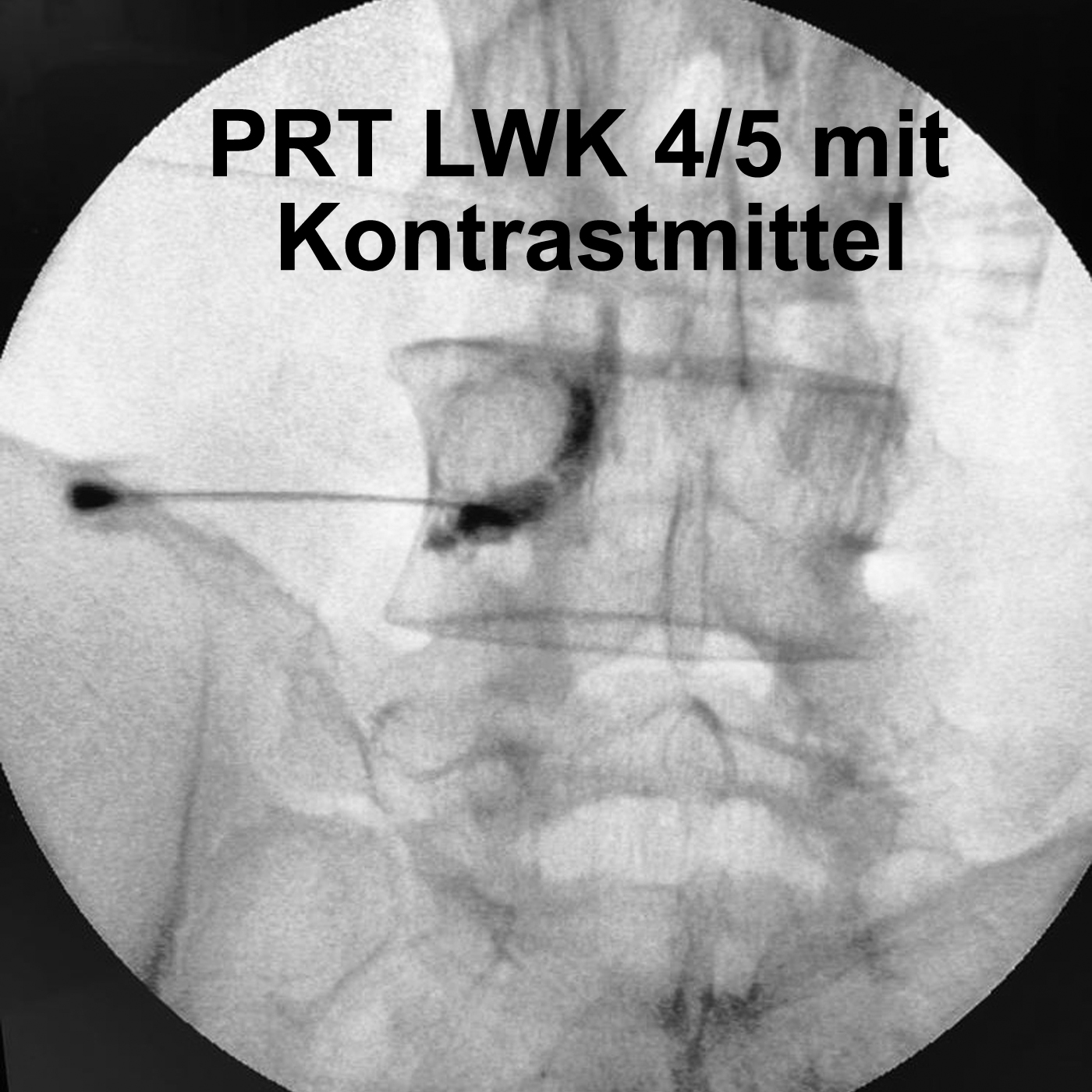 Rückenschmerzen verstehen – Rückenschmerzen beheben. Neurochirurg und Rückenexperte Prof. Dr. Christian Woiciechowsky erklärt wie und warum