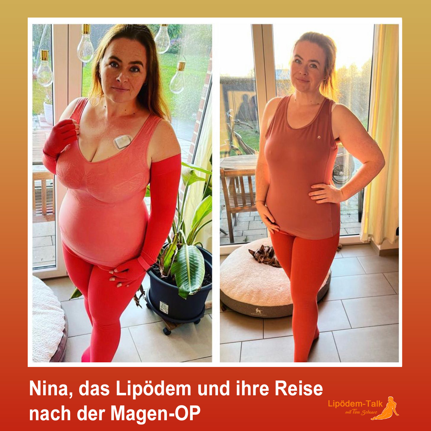 Nina, das Lipödem und ihre Reise nach der Magen-OP episode artwork