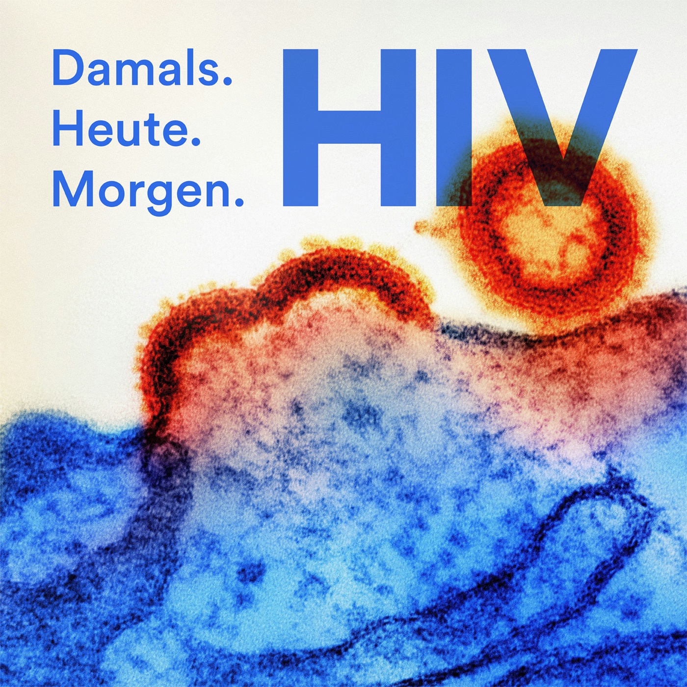 Teaser - HIV. Damals. Heute. Morgen.