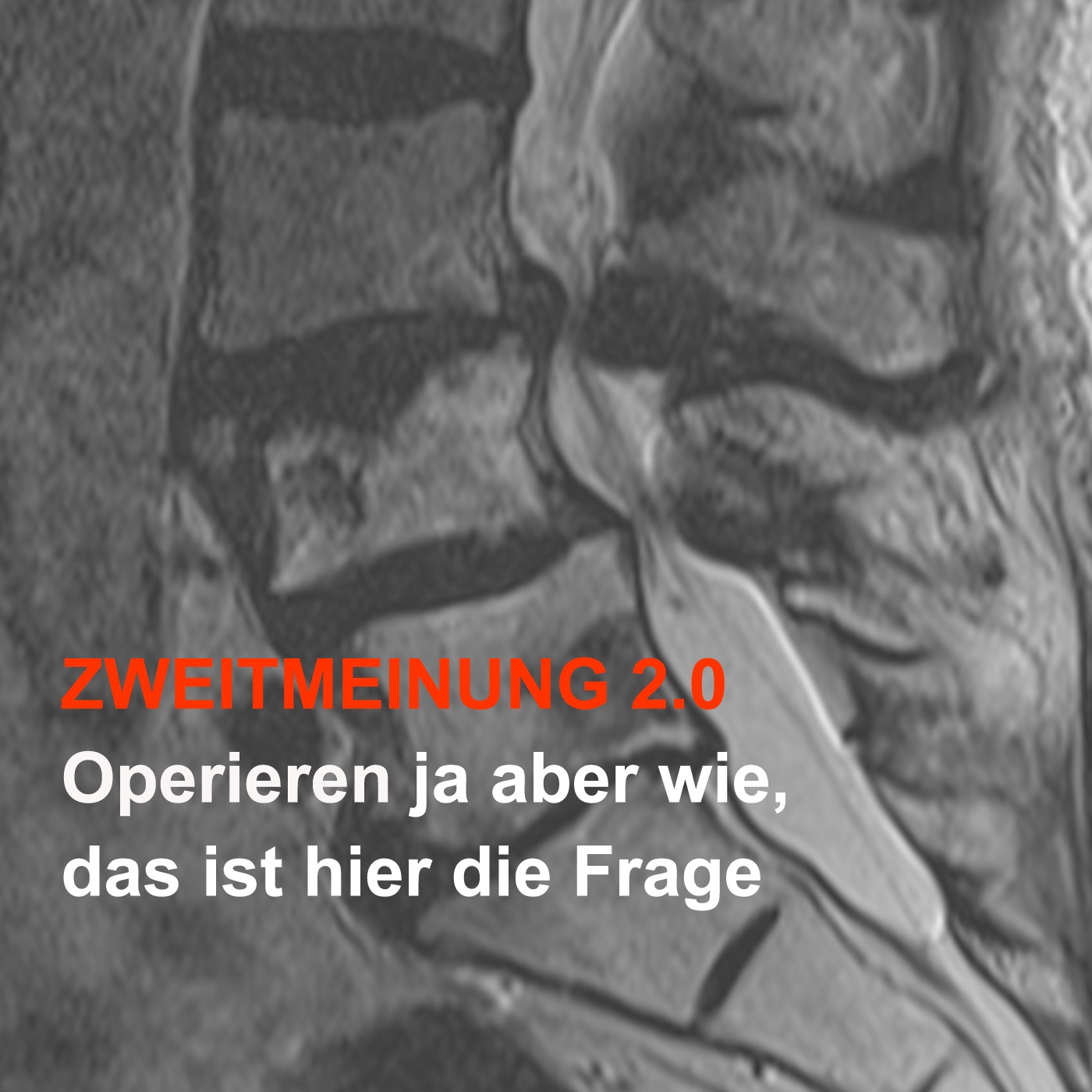 Zweitmeinung 2.0 - Operieren ja aber wie, das ist hier die Frage
