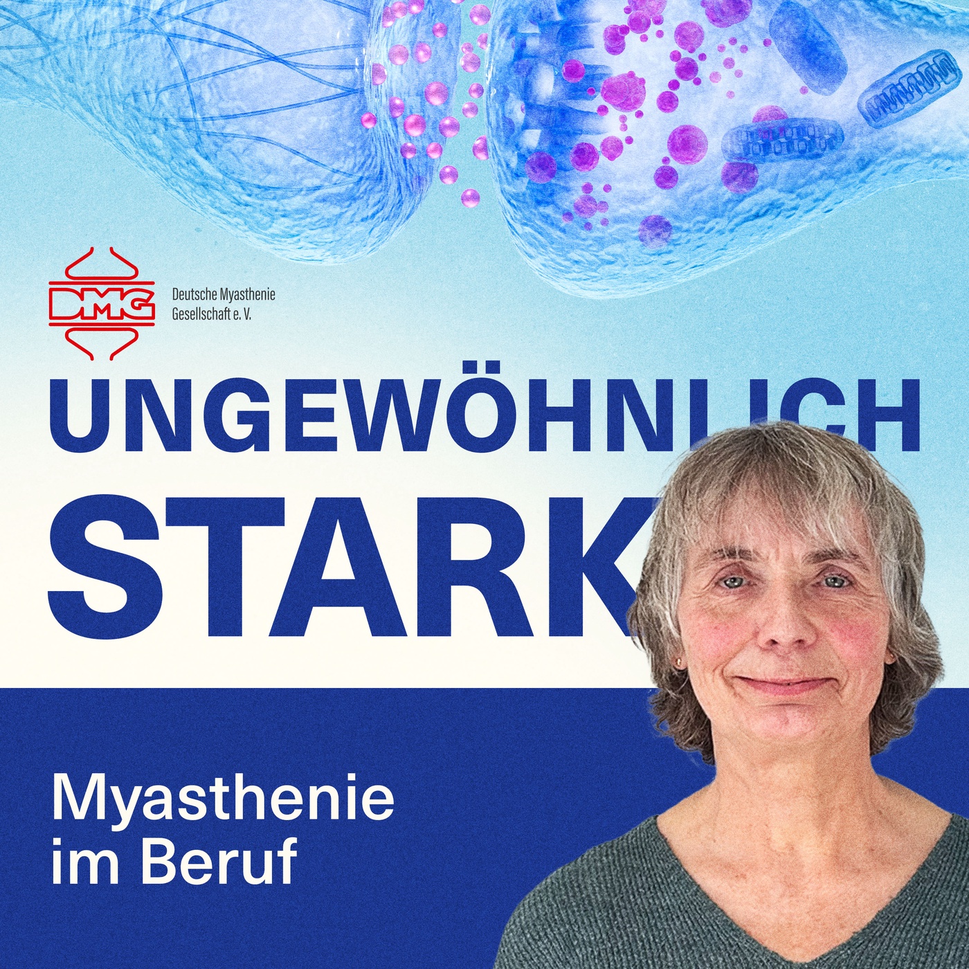 Myasthenie im Beruf