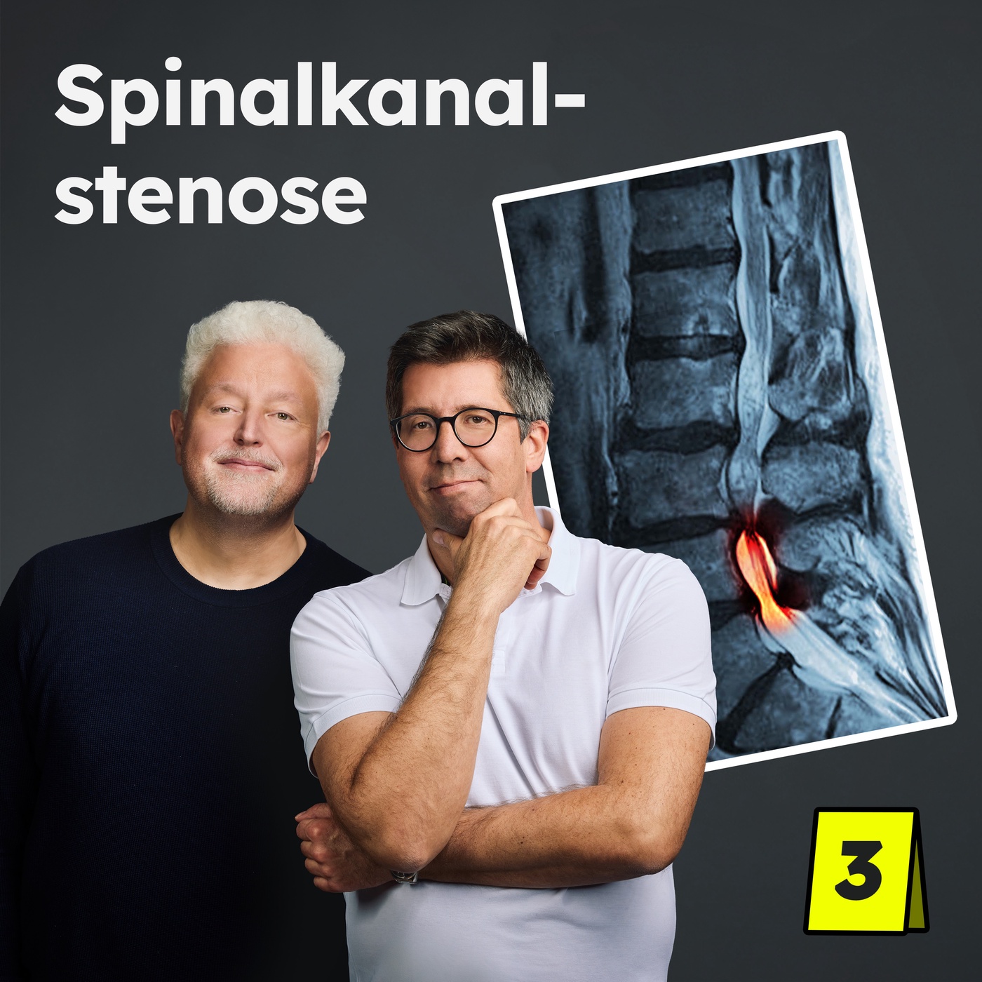 Spinalkanalstenose: Schwere, müde Beine beim Gehen