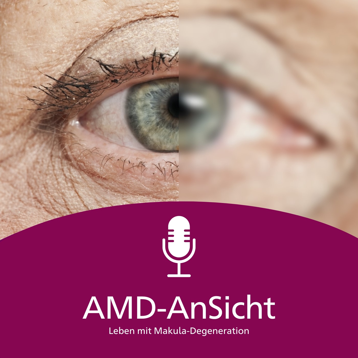 AMD-AnSicht - Leben mit Makuladegeneration
