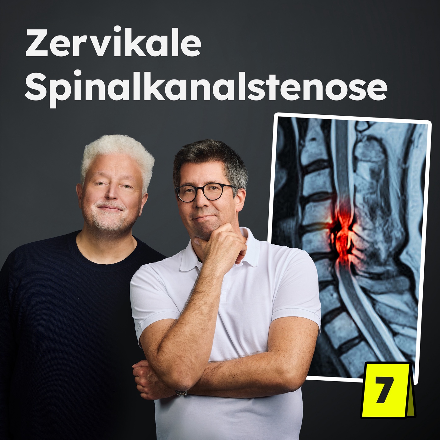 Spinalkanalstenose der Halswirbelsäule: Die rätselhafte Kraftlosigkeit der Hand