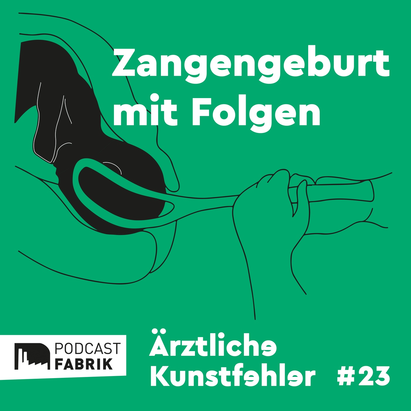 Zangengeburt mit Folgen