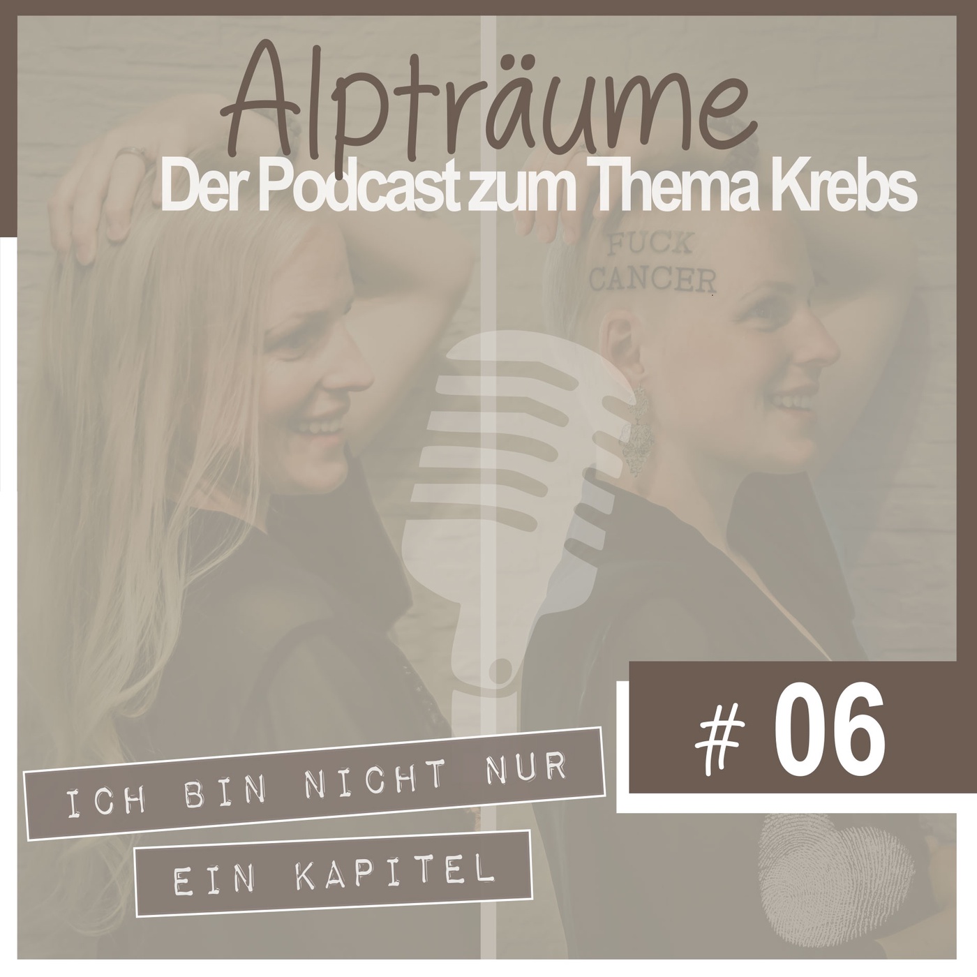 Alpträume