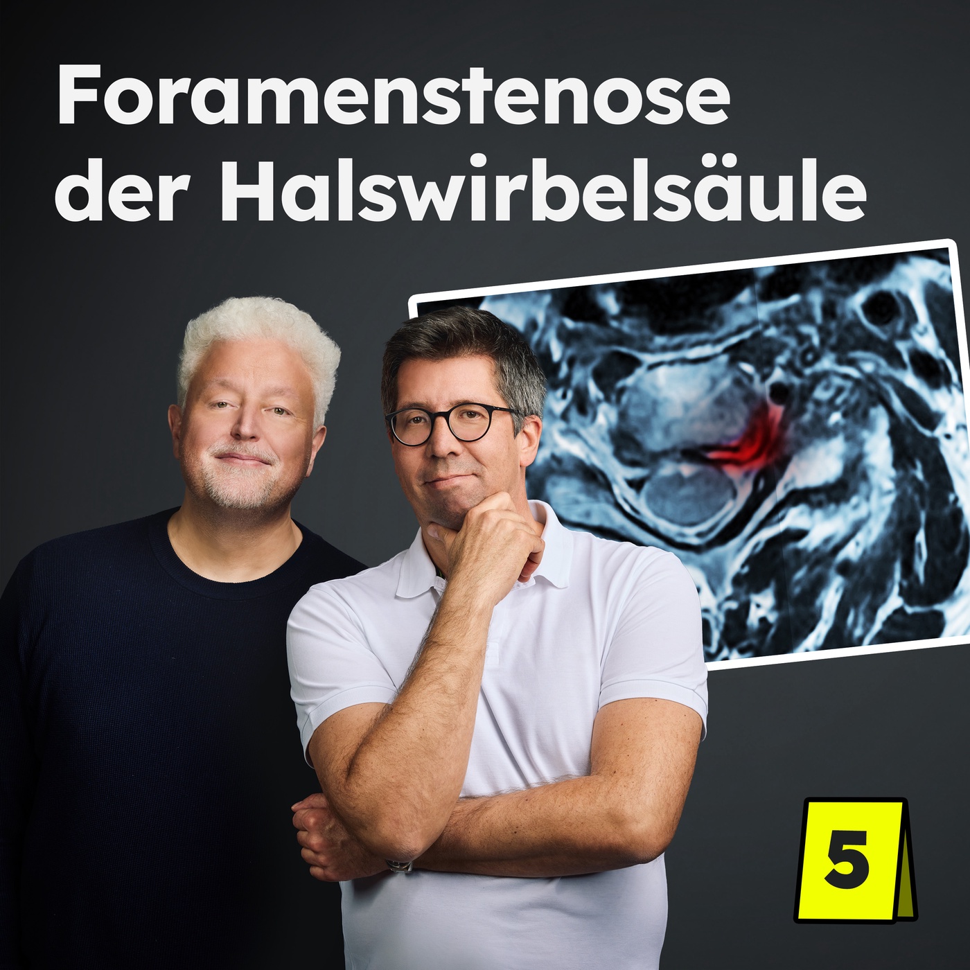 Foramenstenose: Nacken- & Schulterschmerzen, die bis in den Arm ausstrahlen