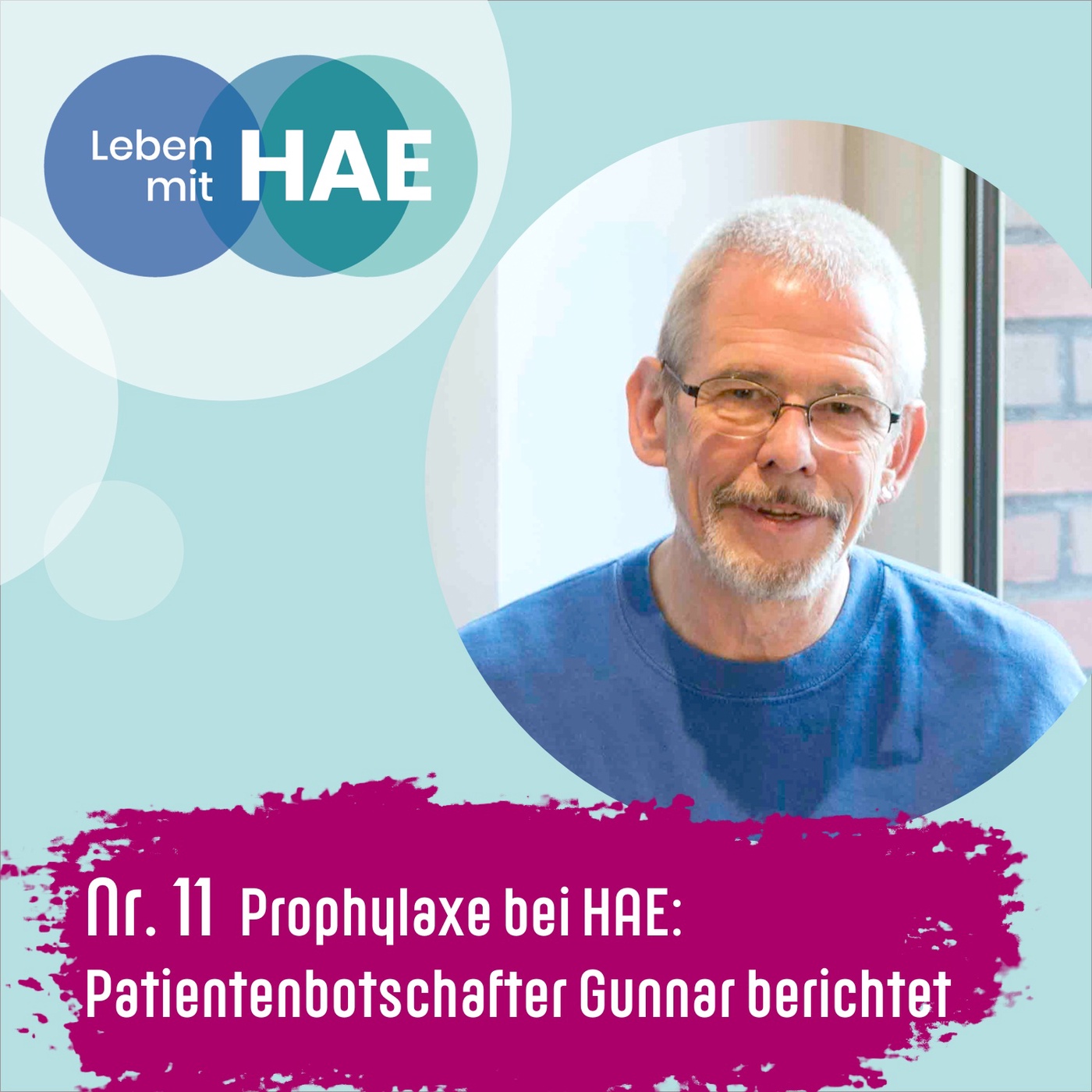 Prophylaxe bei HAE – Patientenbotschafter Gunnar berichtet