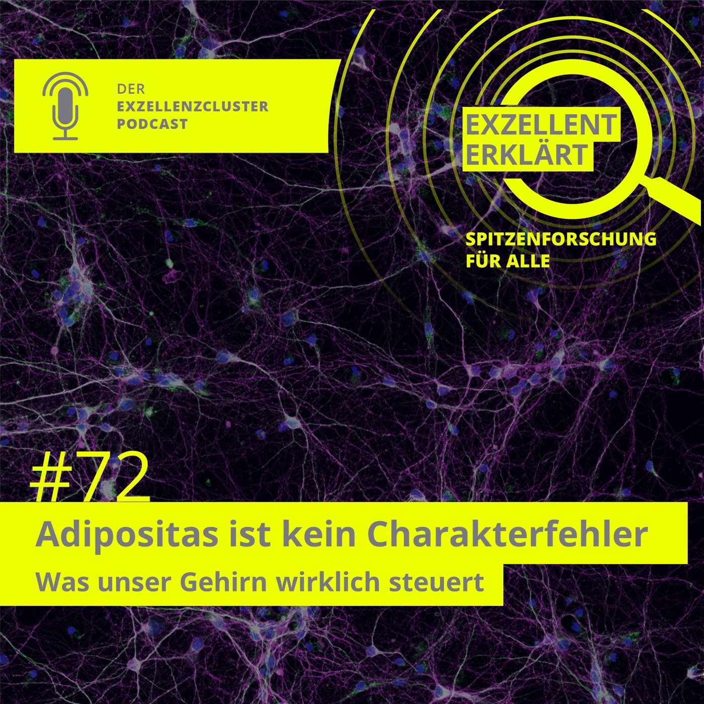 Adipositas ist kein Charakterfehler – Was unser Gehirn wirklich steuert