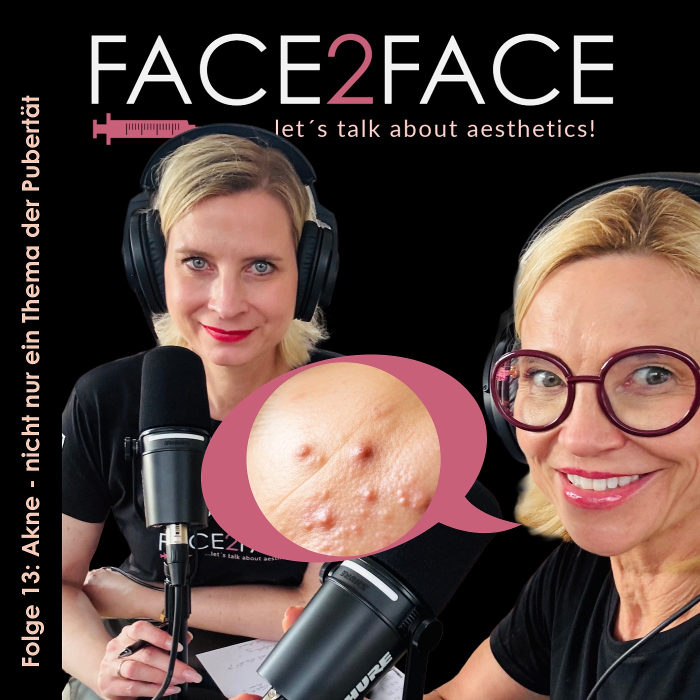 Folge 13: Akne - nicht nur ein Thema der Pubertät