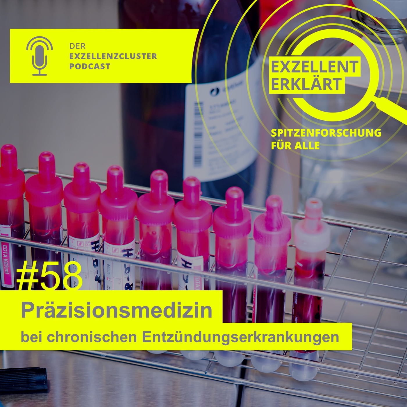 Präzisionsmedizin bei chronischen Entzündungserkrankungen