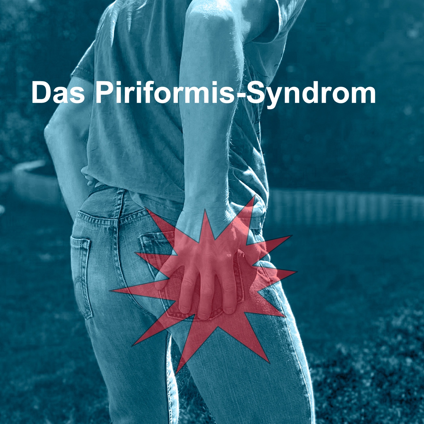 Piriformis-Syndrom oder Bandscheibenvorfall? 