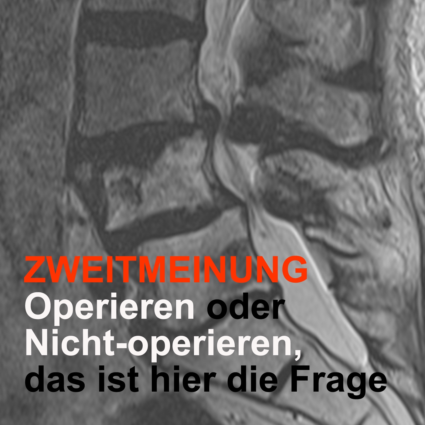 ZWEITMEINUNG - Operieren oder  Nicht-operieren,  das ist hier die Frage