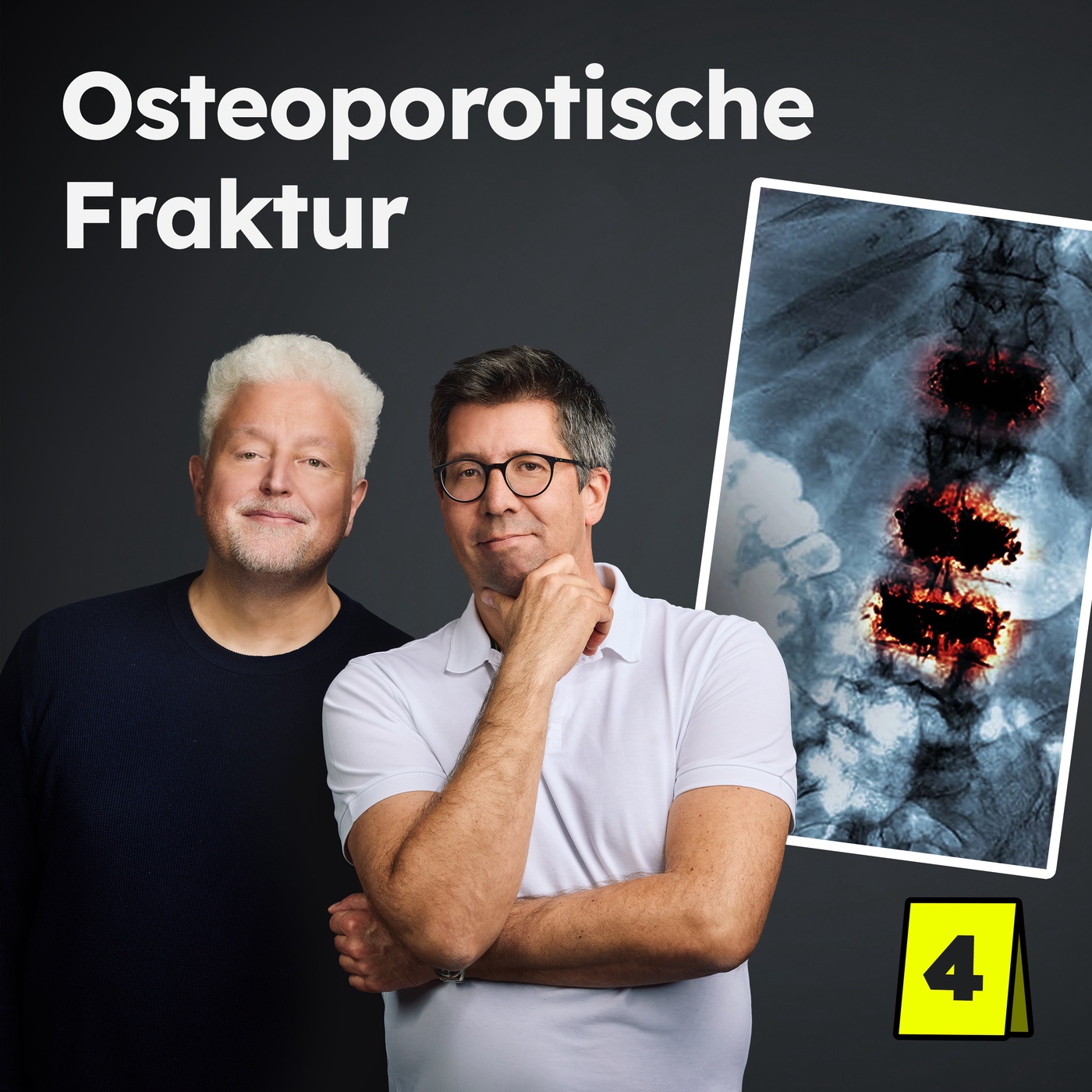 Osteoporotische Fraktur: Wirbelbruch aus dem Nichts